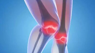 Photo of यूपी के डाक्टर ने विकसित की घुटना रोग के उपचार की सस्ती प्लेट